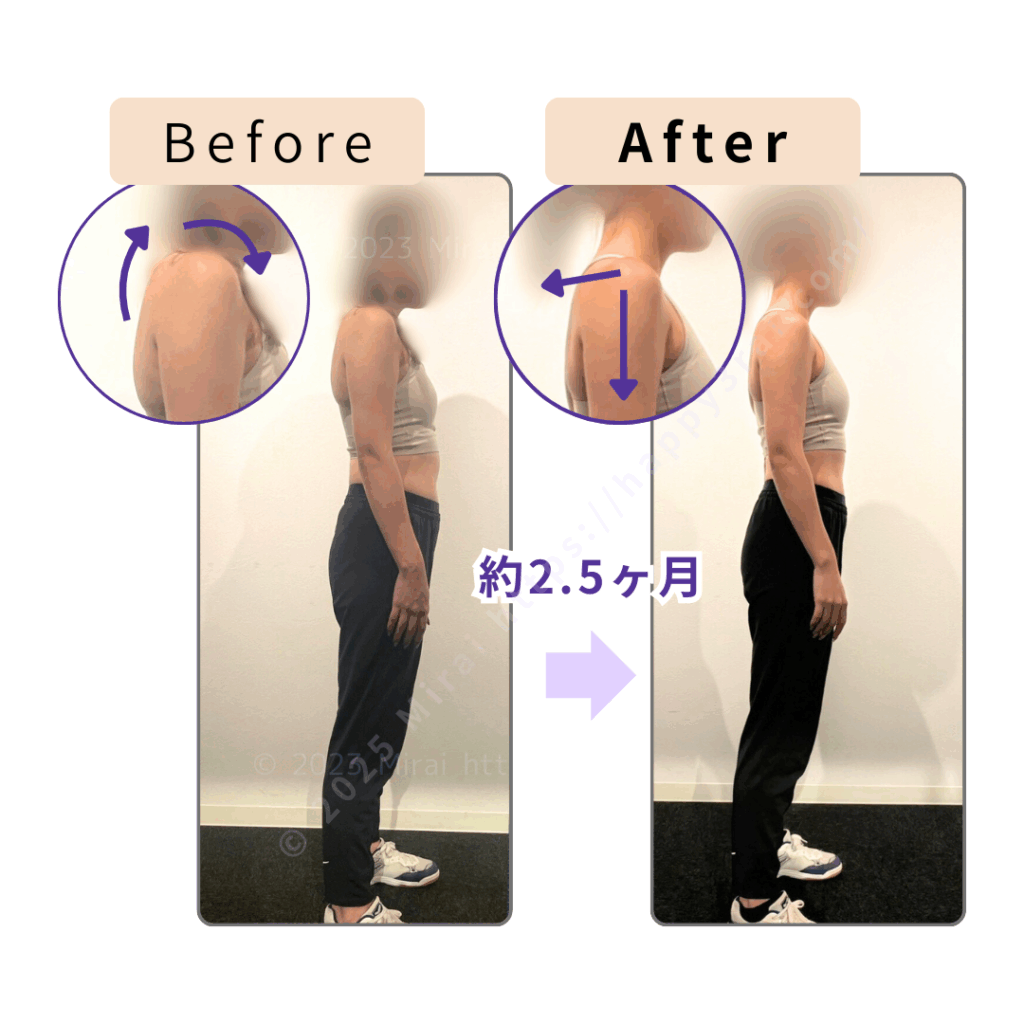 姿勢改善・背中の引き締め2ヶ月半のボディメイク_Before-After
