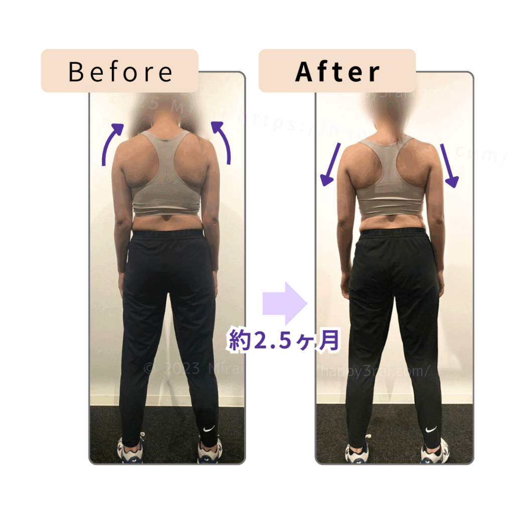 姿勢改善・背中の引き締め2ヶ月半のボディメイク_Before-After